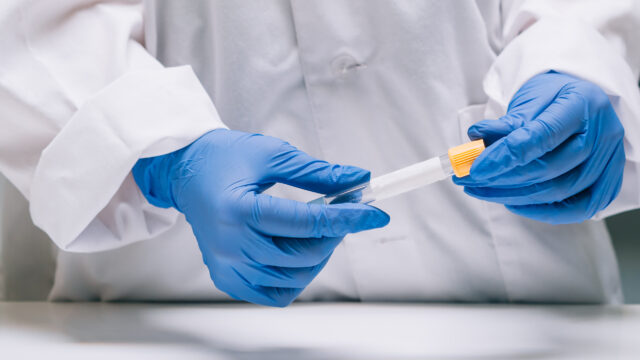 Female medical or scientific researcher holds in hands a test tube in a laboratory.
